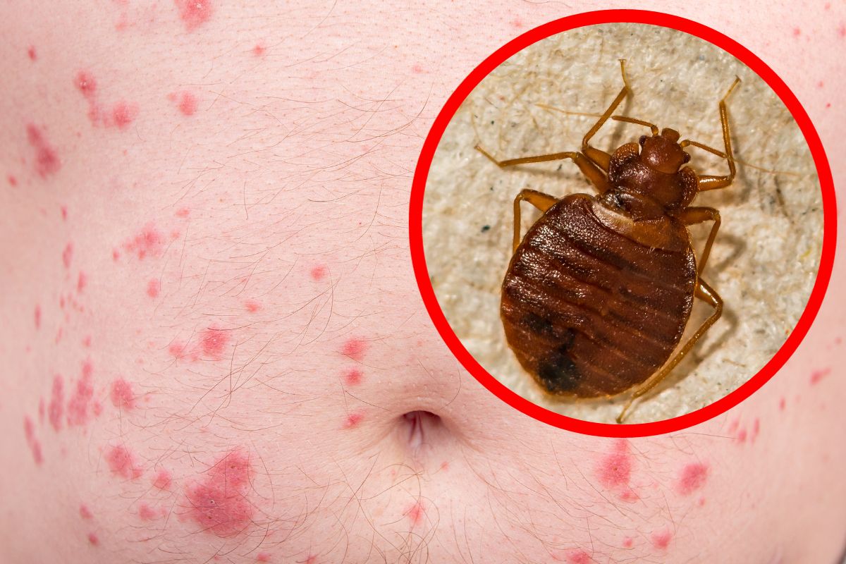 On a enfin trouvé la solution miracle pour se débarrasser définitivement des punaises de lit